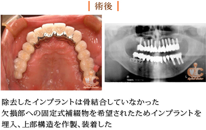 術後