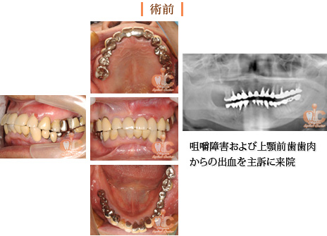 術前