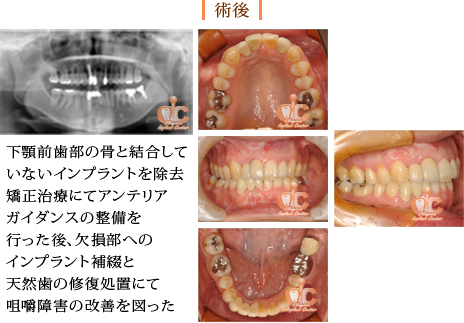 術後