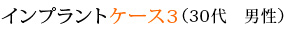 インプラントケース3（30代　男性）