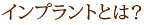 インプラントとは？