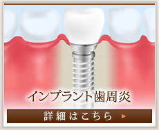 インプラント歯周炎