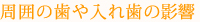 周囲の歯や入れ歯の影響