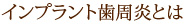 インプラント歯周炎とは